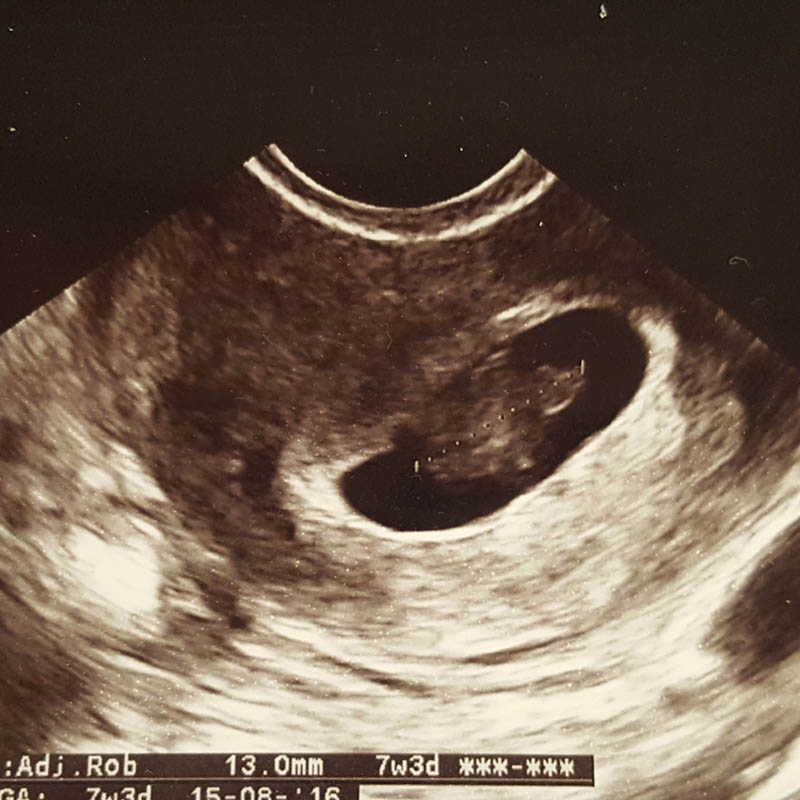 mama-fawn-een-positieve-zwangerschapstest-precies-1-jaar-geleden-7