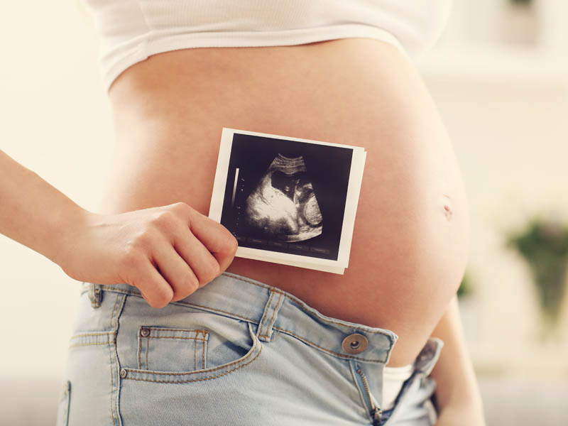 Beste Zorgverzekering Zwangerschap 2021 Zorgverzekering Zwangerschap In 2021 Tips En Advies Babystraatje Nl